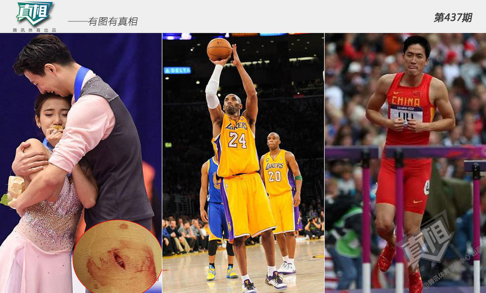 【真相】重伤都不下火线！神人断头继续守门