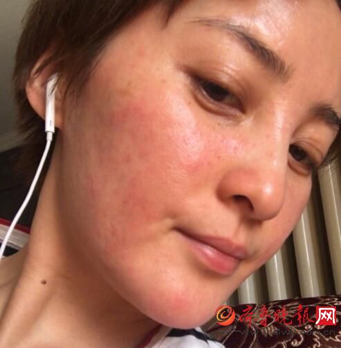 蒋勤勤的脸怎么了？蒋勤勤撞脸尹正周笔畅 回应“吓着大家了”获关心