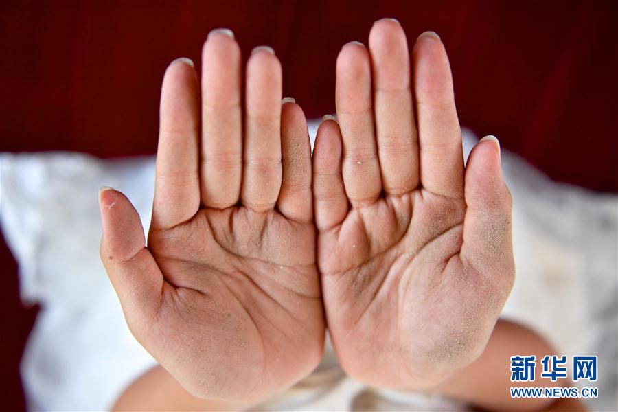 折翼的舞蹈天使