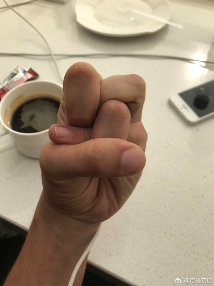 主持人李思思能把手掰成这样你能做到哪个